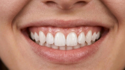 Dental implant treatment for missing teeth