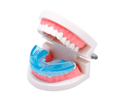 Custom-fitted mouthguard positioned on a dental model