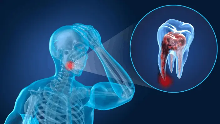 Dental emergency involving a damaged tooth