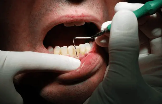 Dentist performing a periodontal examination