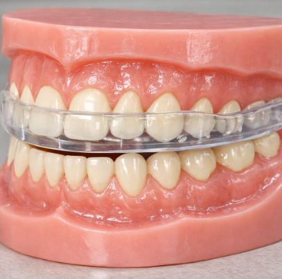 Custom nightguard fitted over a dental model to protect teeth
