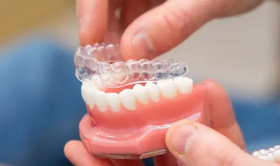 Clear dental aligner shown on a dental model