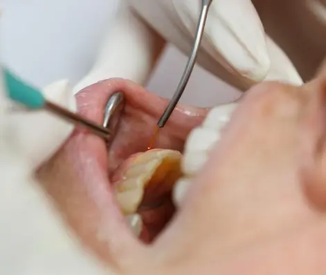 Dental laser being used during a periodontal procedure